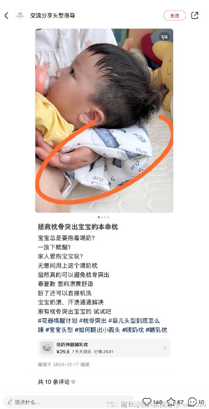 小红书案例分享第55波-婴儿头型评估看了这么多案例，这个这个玩法我觉得挺狠